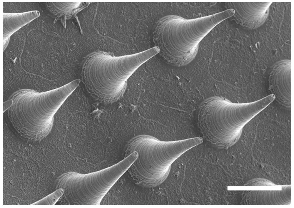 Layered microneedle, layered microneedle contraceptive system and preparation method and application of layered microneedle contraceptive system