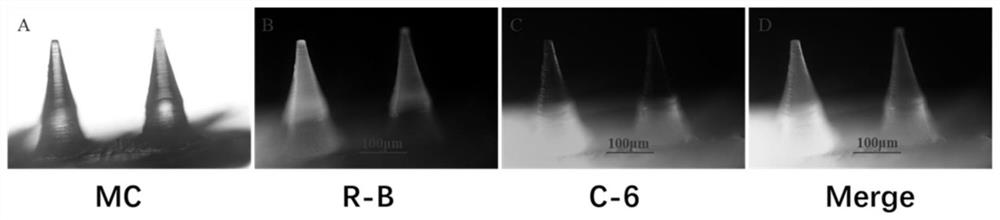 Layered microneedle, layered microneedle contraceptive system and preparation method and application of layered microneedle contraceptive system