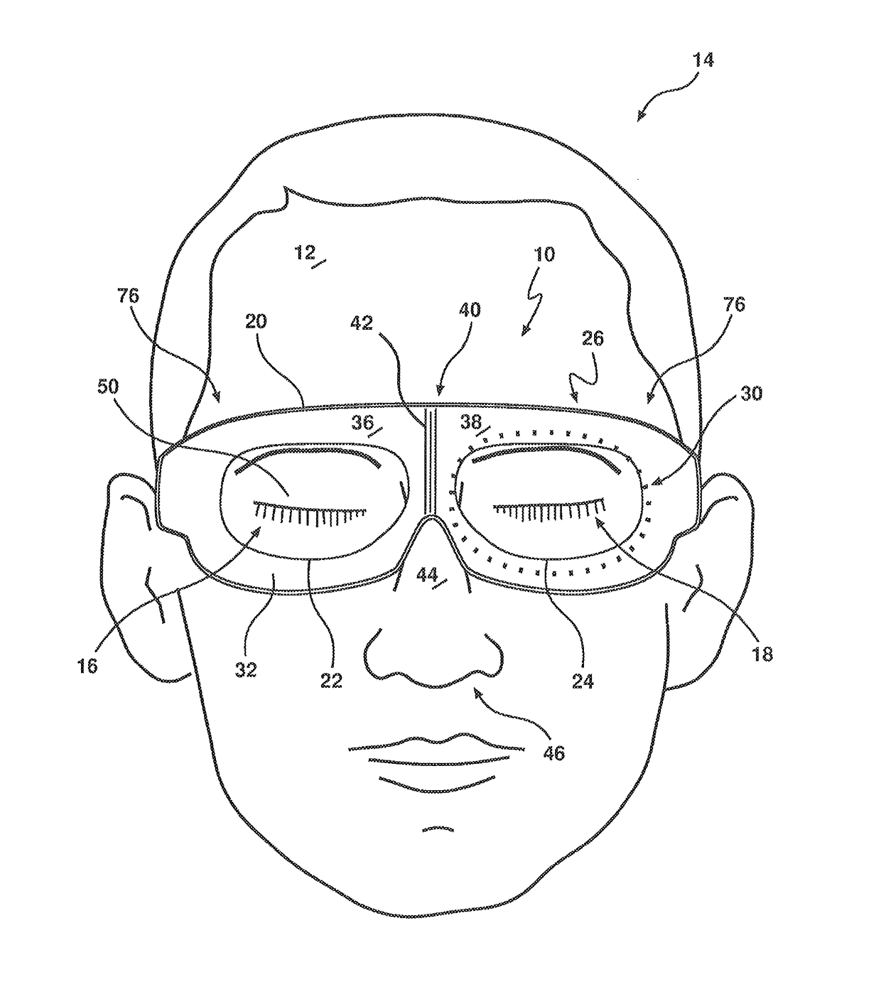 Surgical eye shield