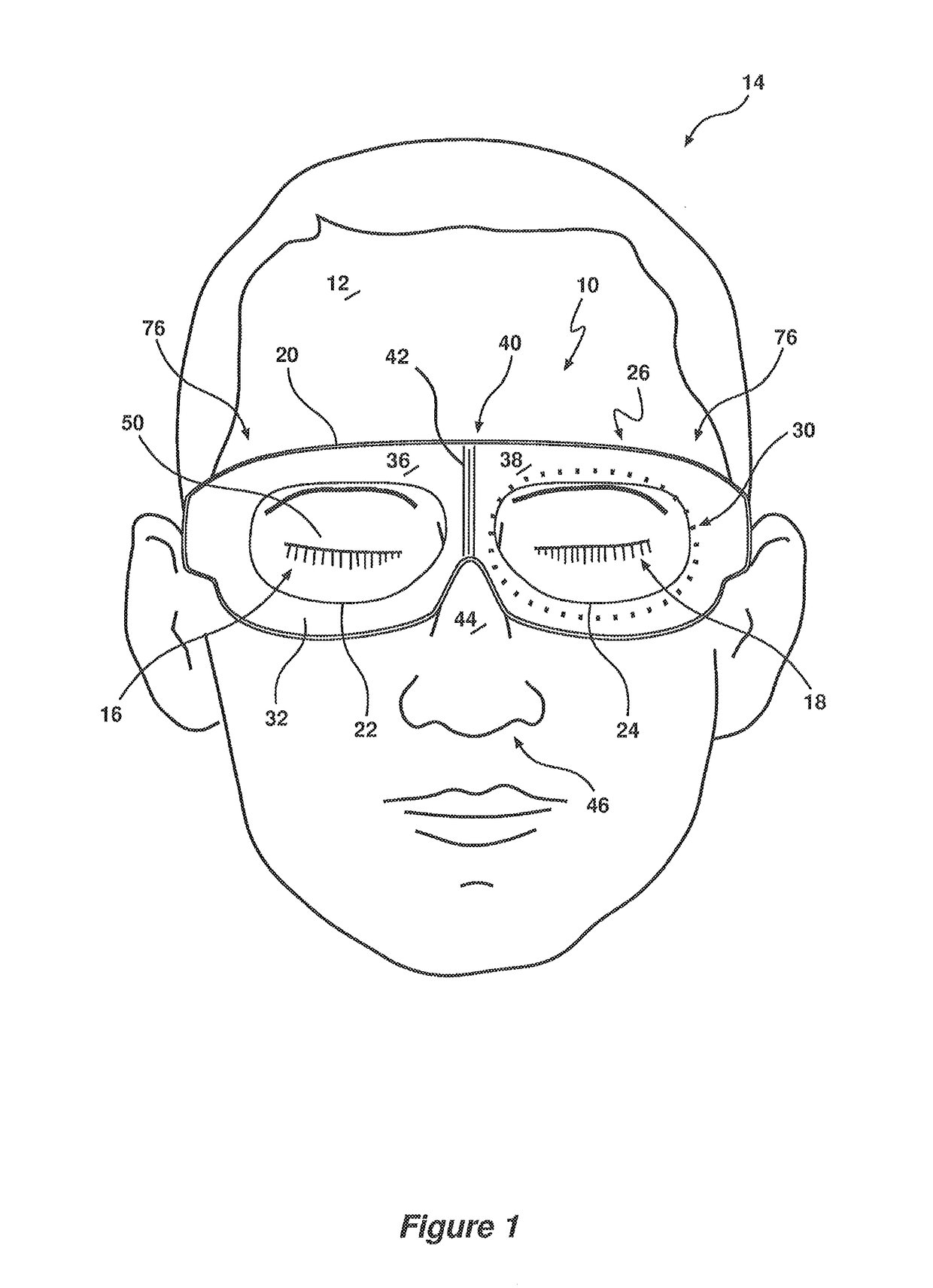 Surgical eye shield