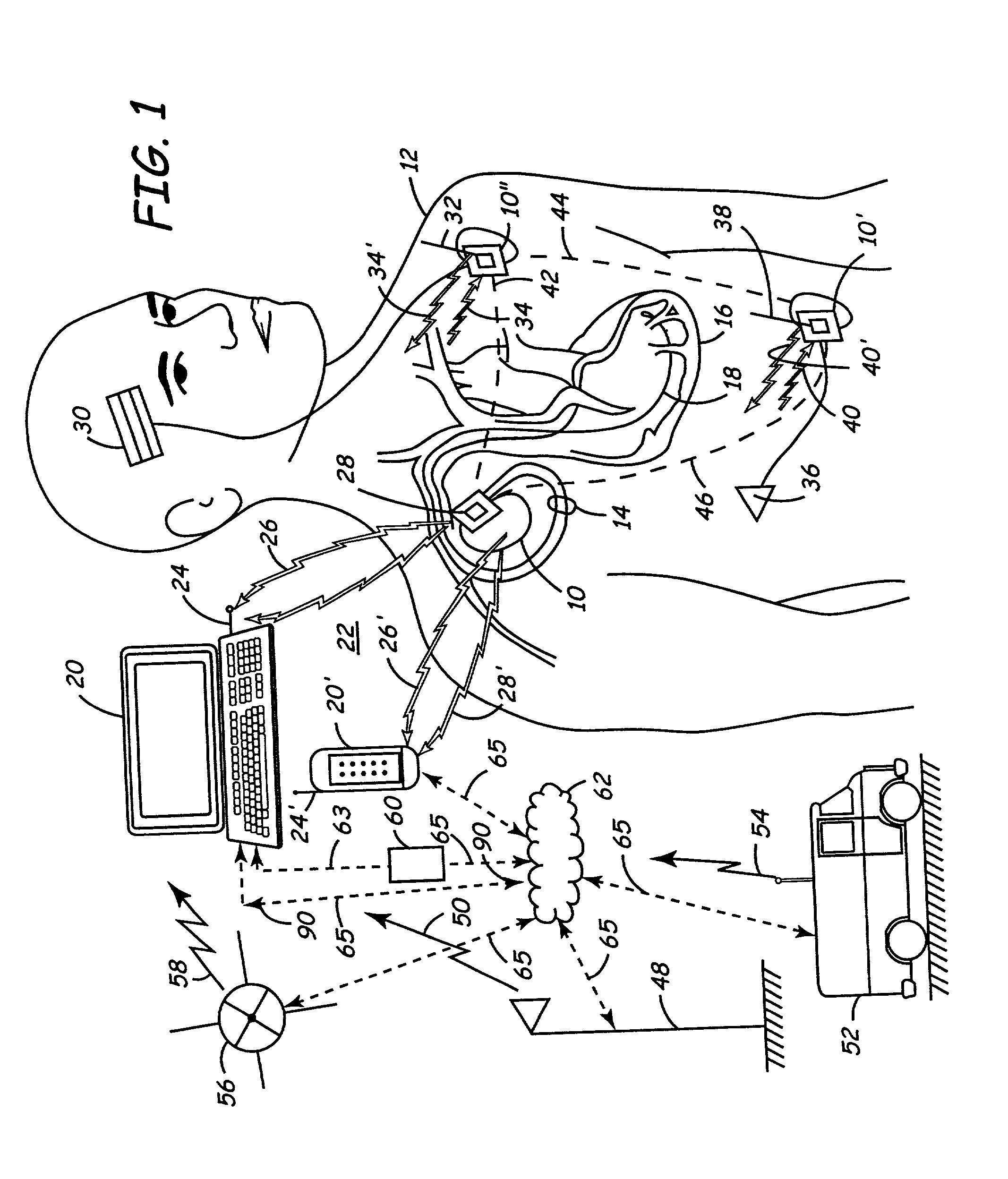 Apparatus and method for automated invoicing of medical device systems