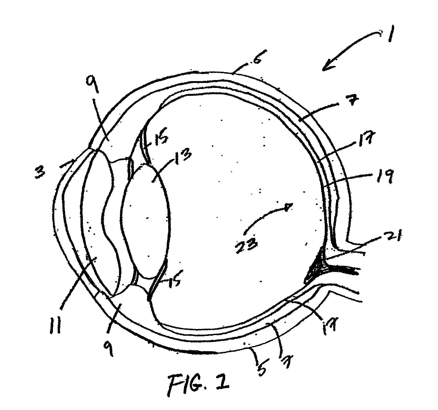 Ophthalmic instrument having hartmann wavefront sensor deriving location of spots with spot fitting techniques