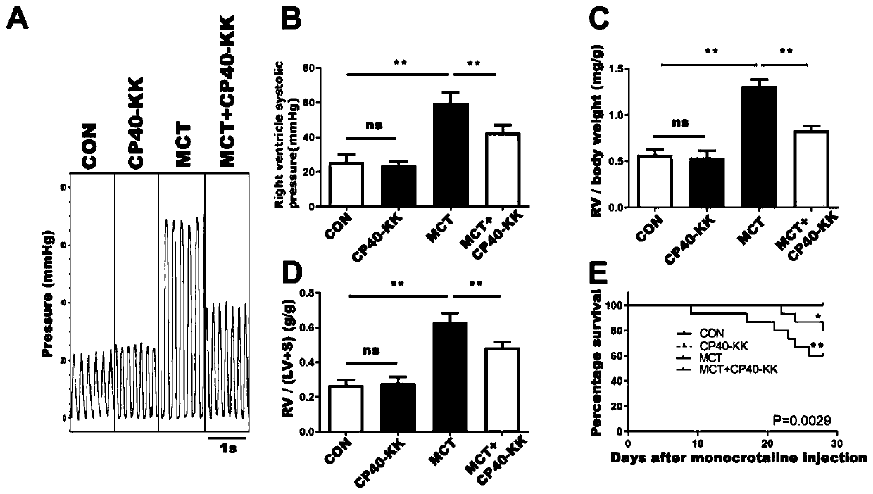 Application of complement C3 inhibitor CP40-KK in preparation of medicine for preventing and treating pulmonary arterial hypertension