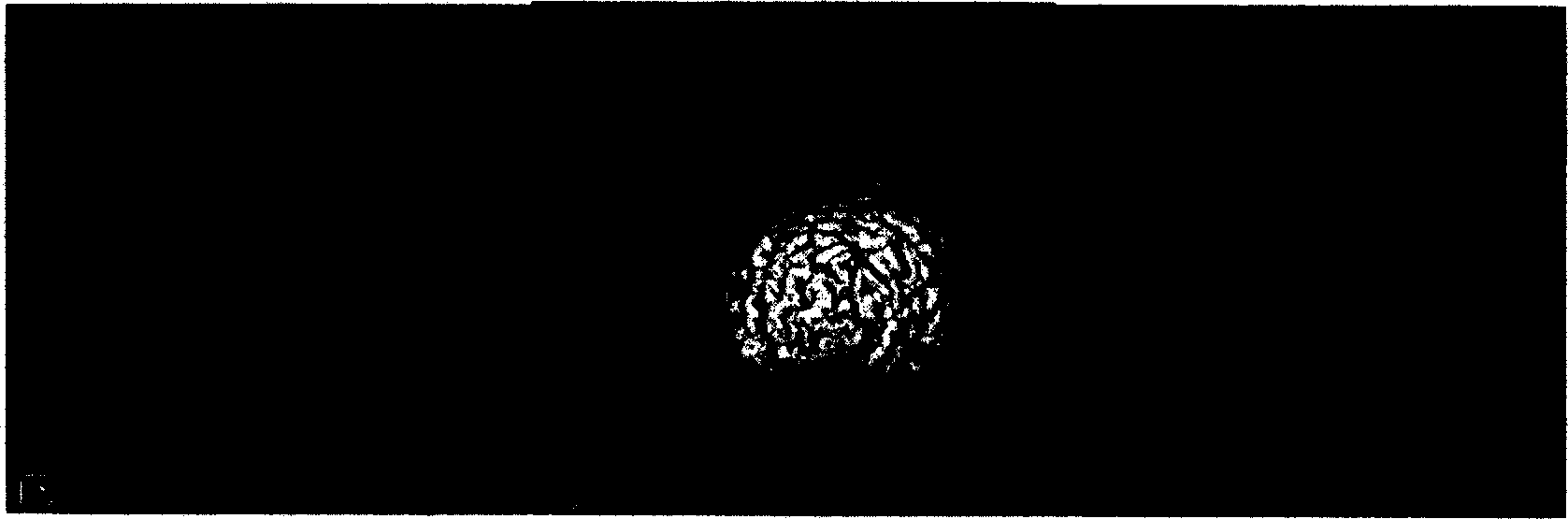 Method for correcting brain tissue deformation in navigation system of neurosurgery