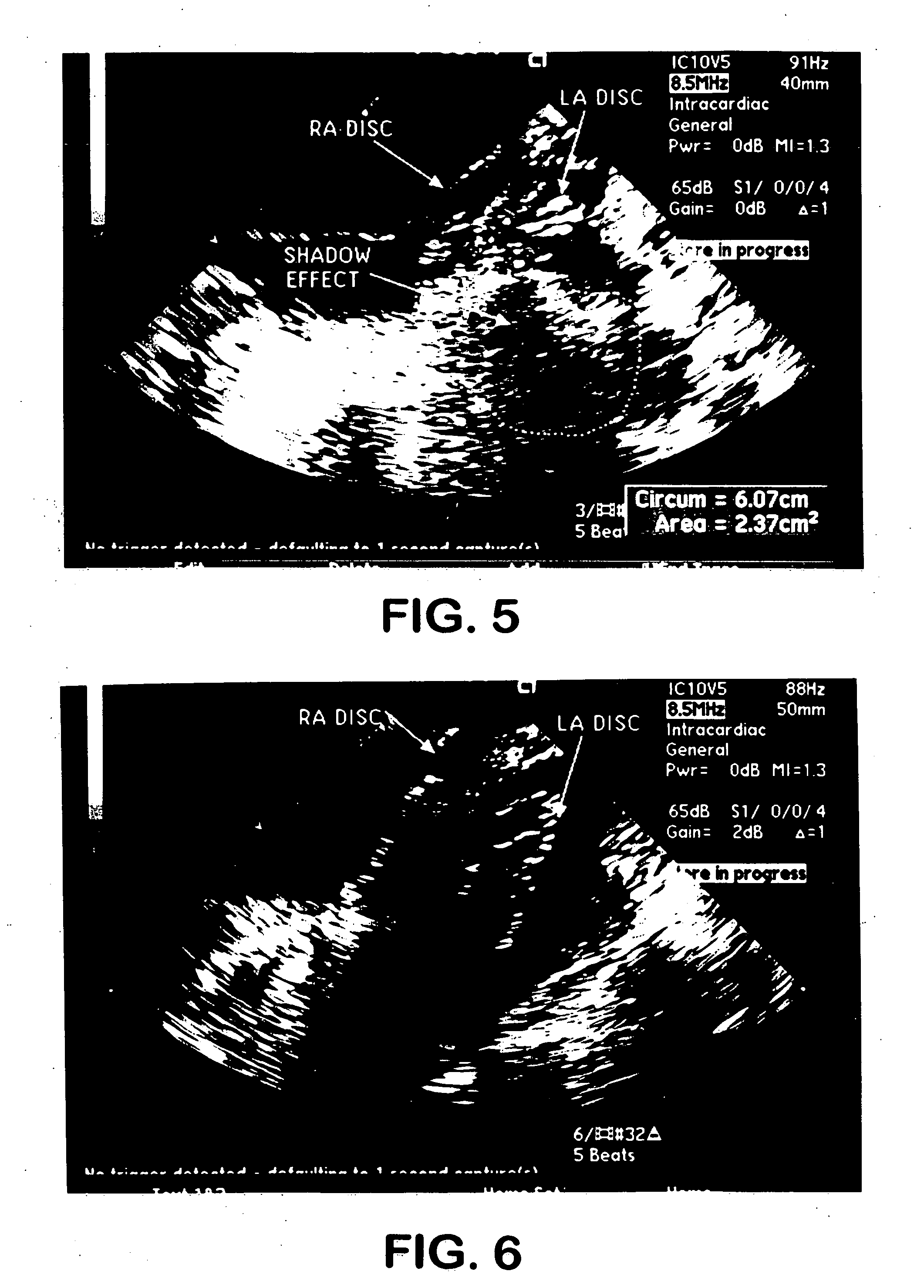 Implantable product with improved aqueous interface characteristics and method for making and using same