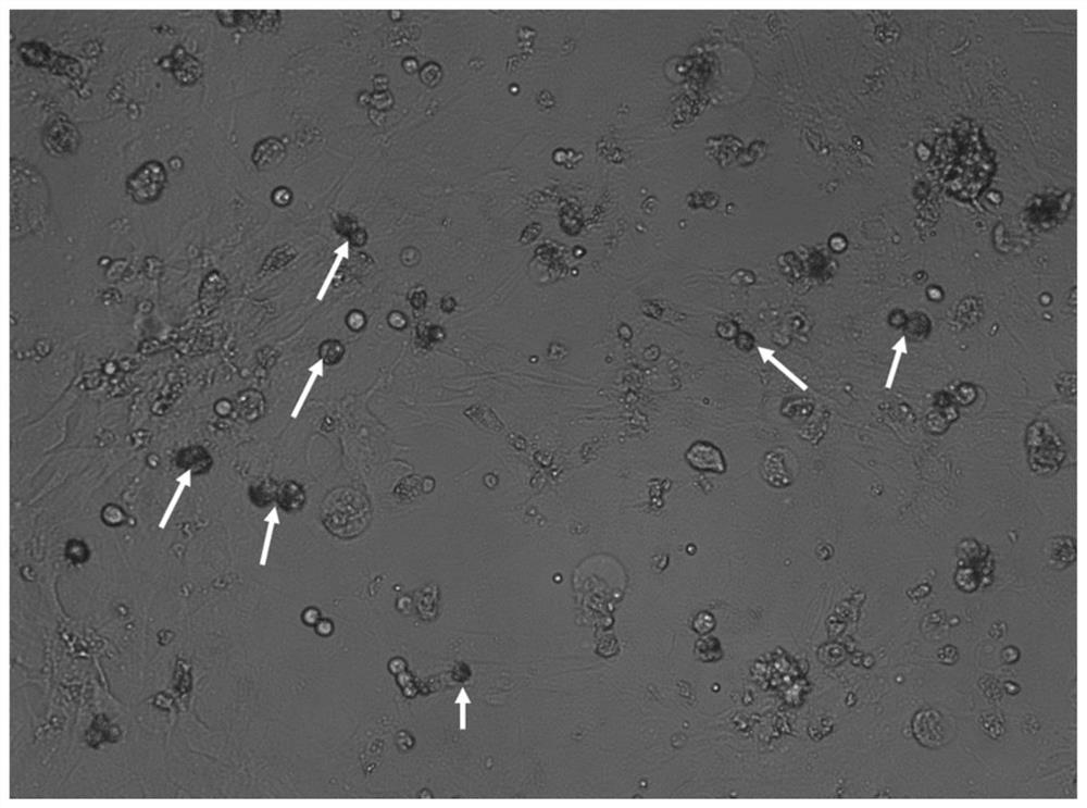 Female chicken primordial germ cell expansion in vitro culture system and application thereof