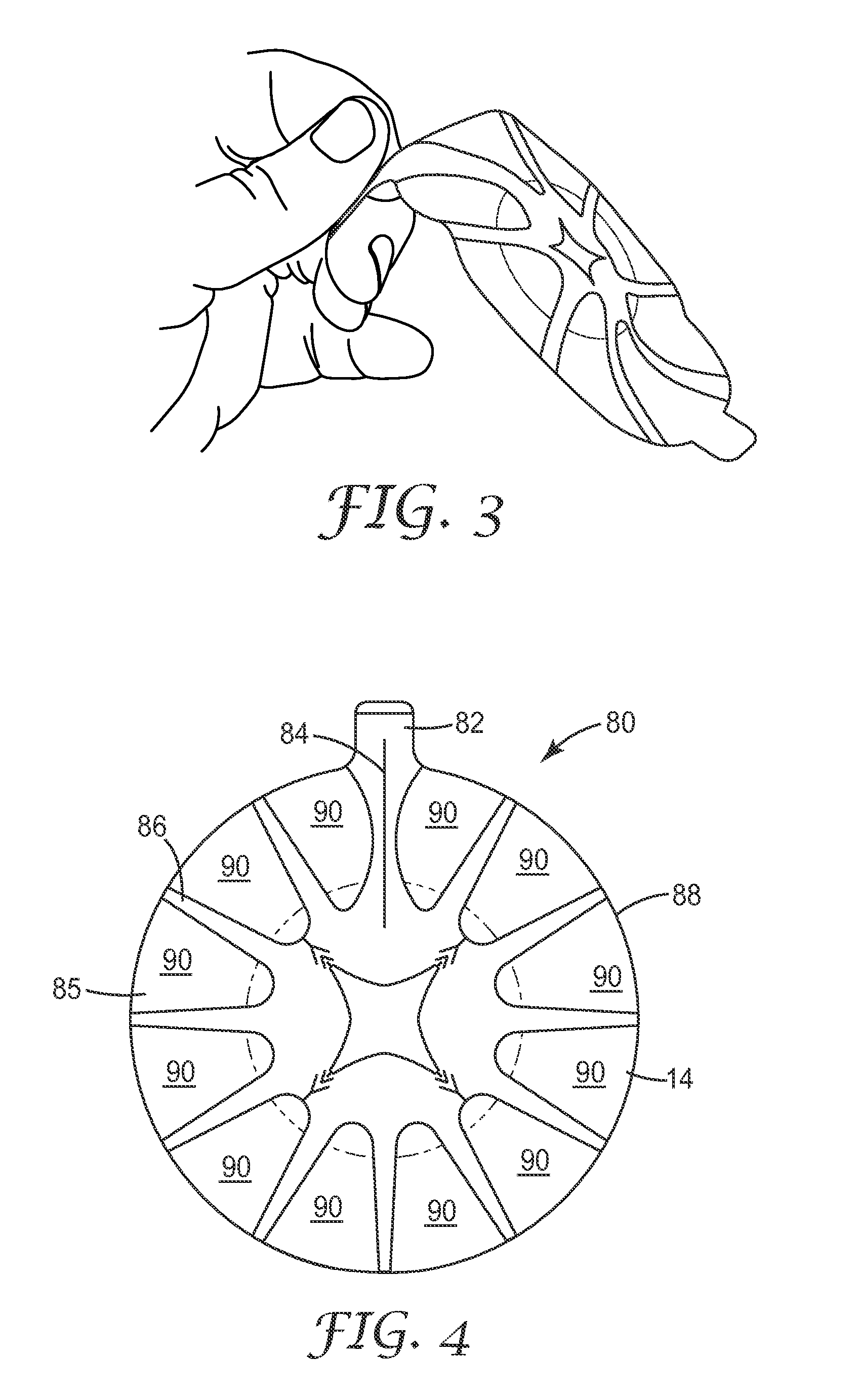 Conformable wound dressing