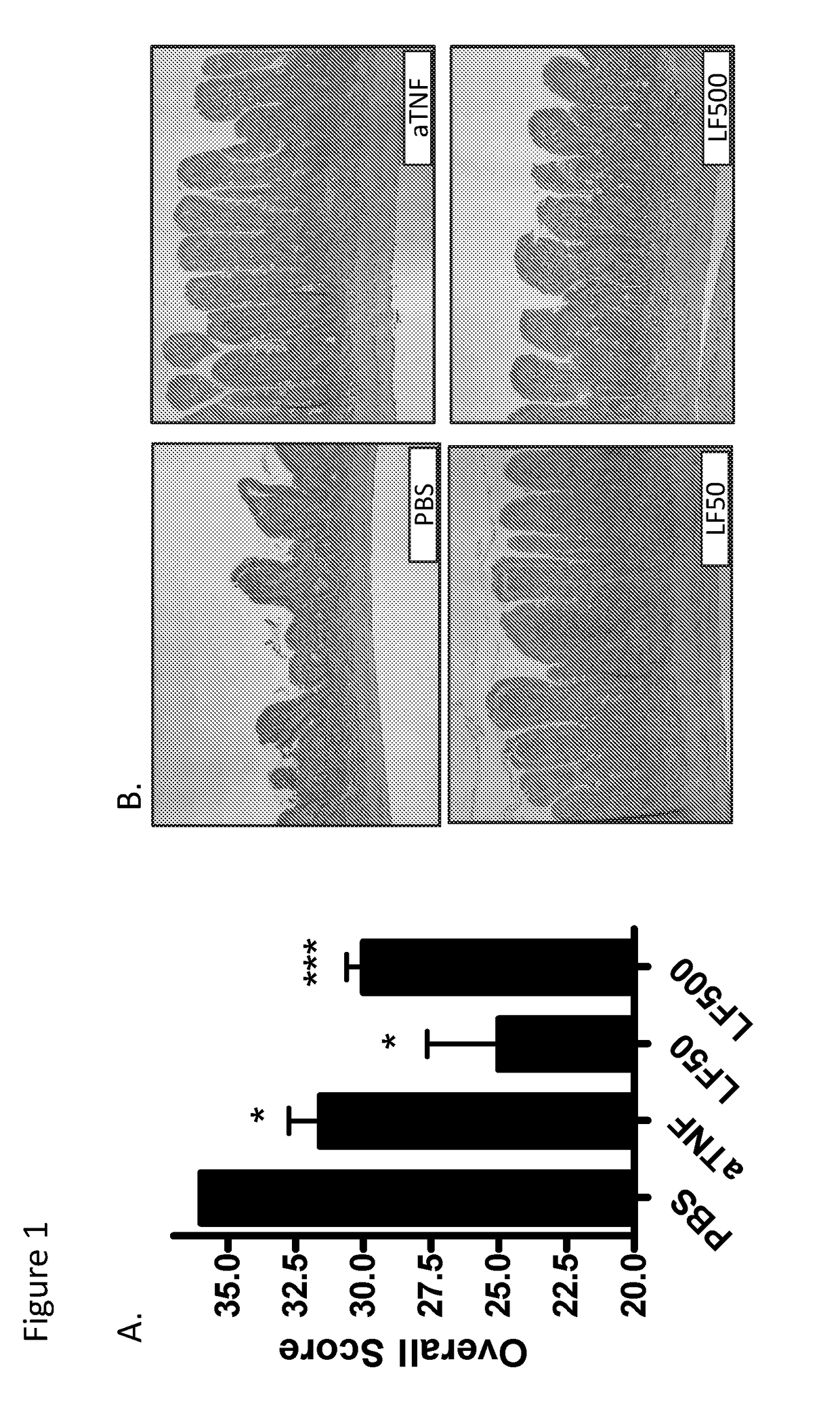 Lactoferrin compositions and methods for modulation of t cell subtypes and treatment of autoimmune diseases