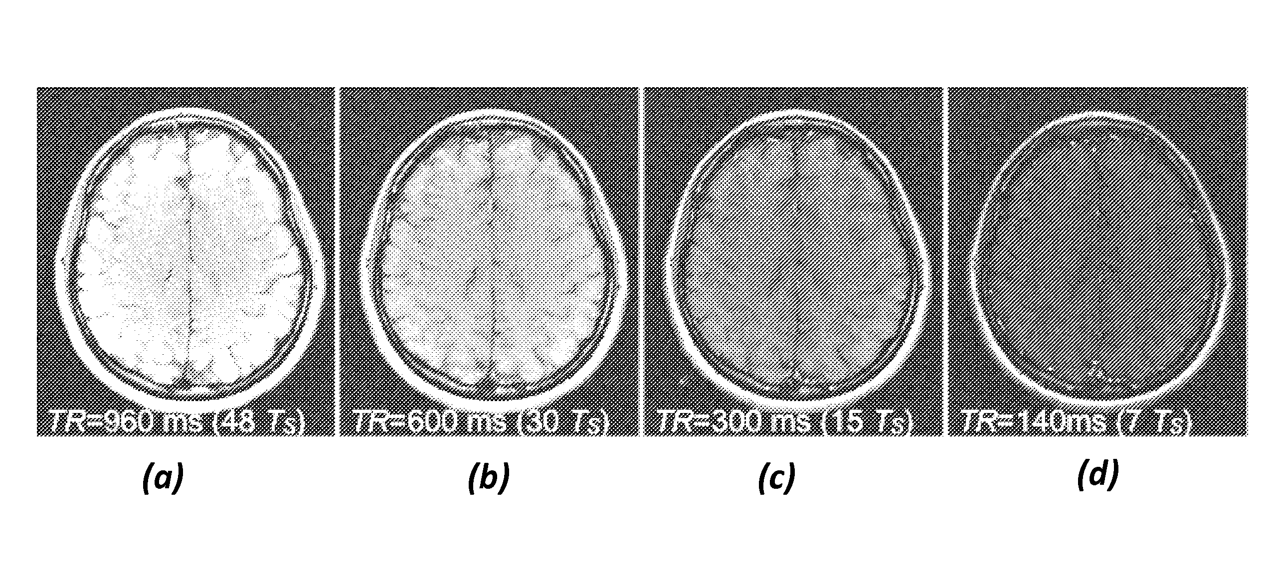 Flexible Ordering for Multiple Slice MRI