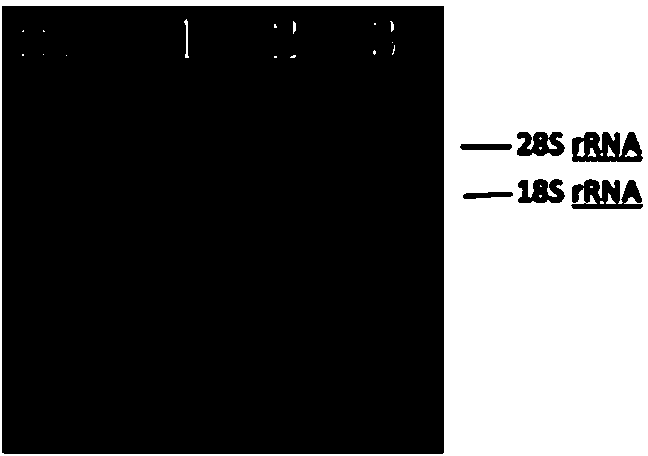 Method for extracting RNA from calcified tissue