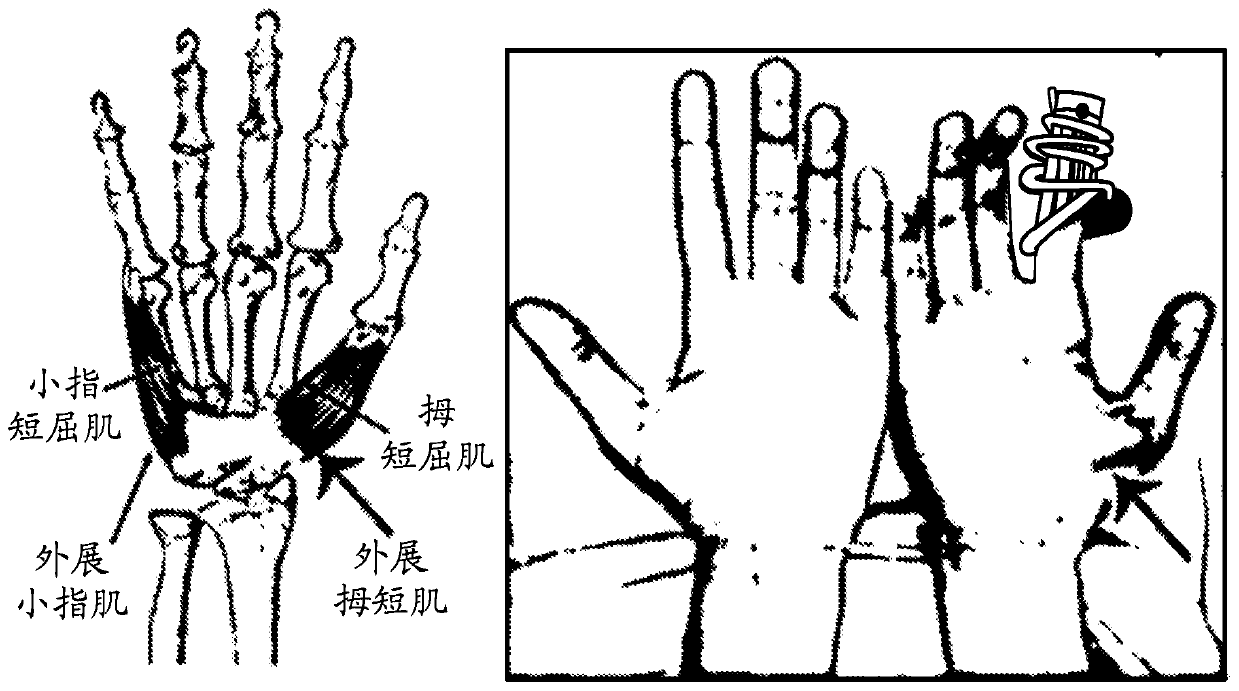 Compositions and methods for preventing or treating muscle conditions