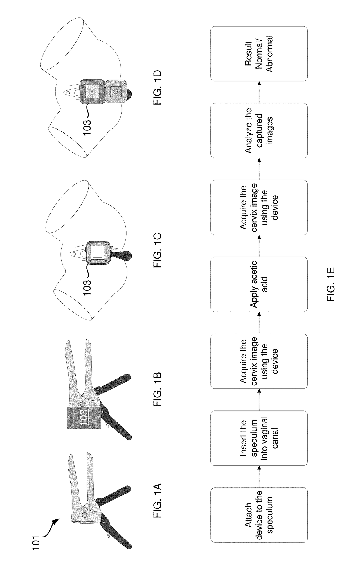 Device and apparatus to facilitate cervix cancer screening