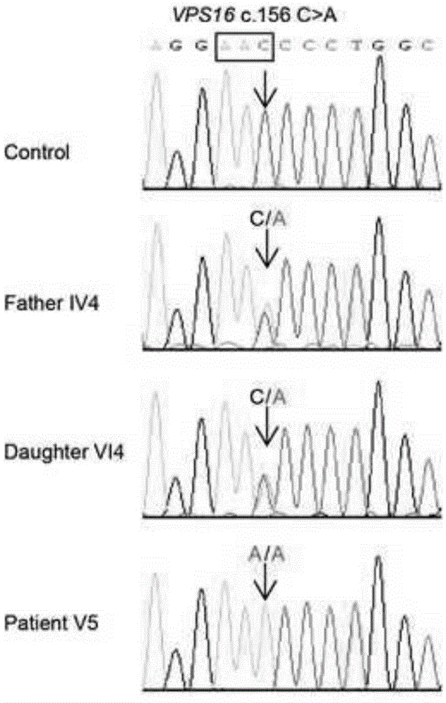 Detection primers, method and kit for myodystonia VPS16 gene