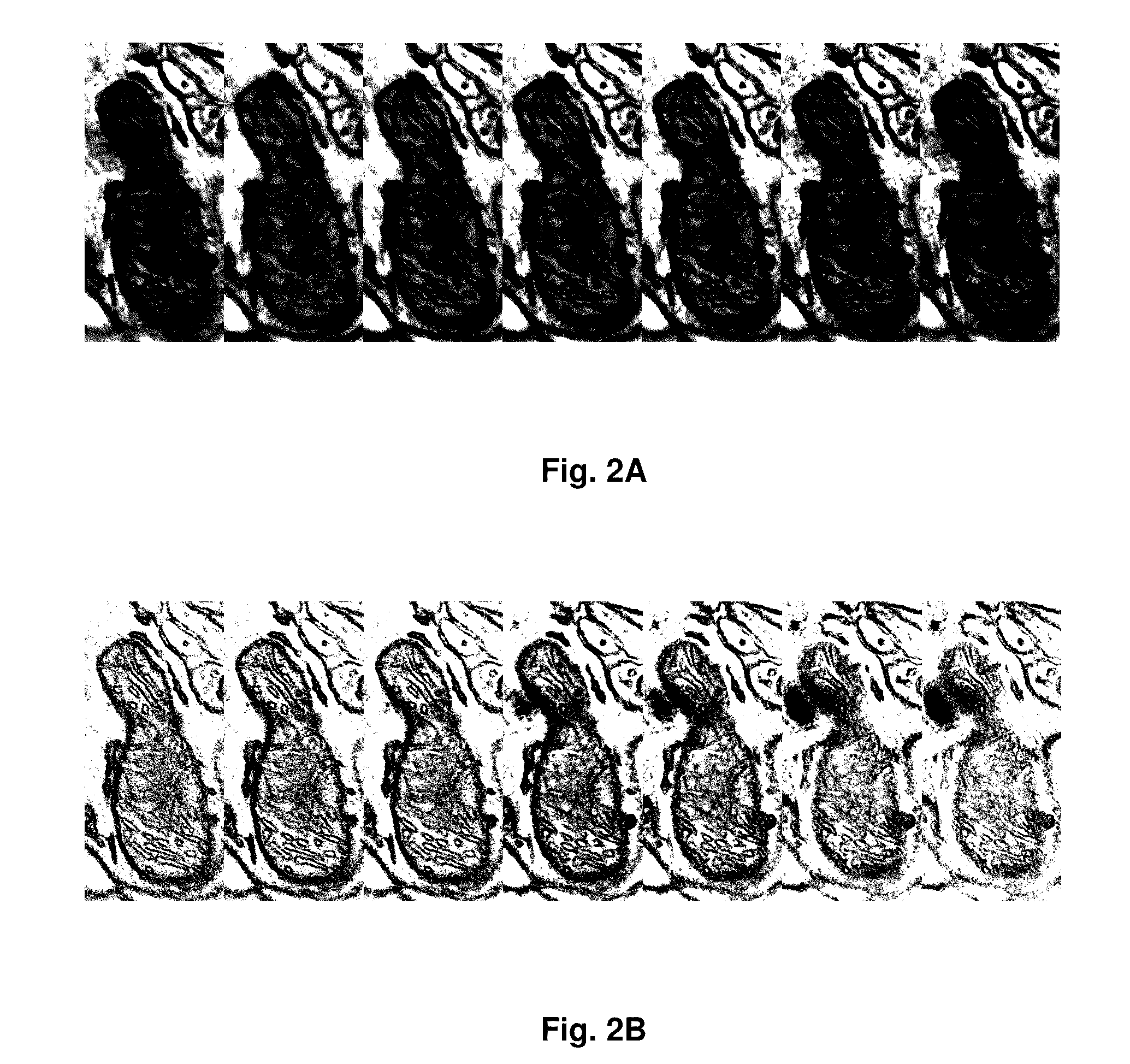 SEM imaging method