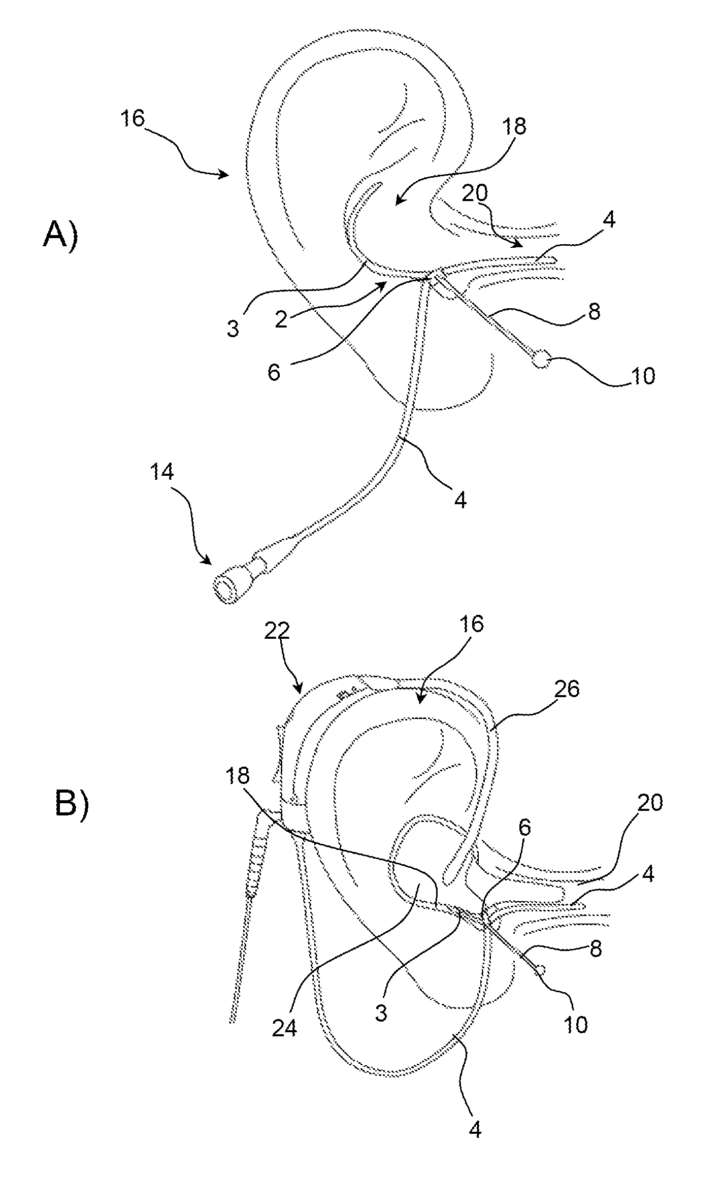 Ear strap for a probe tube