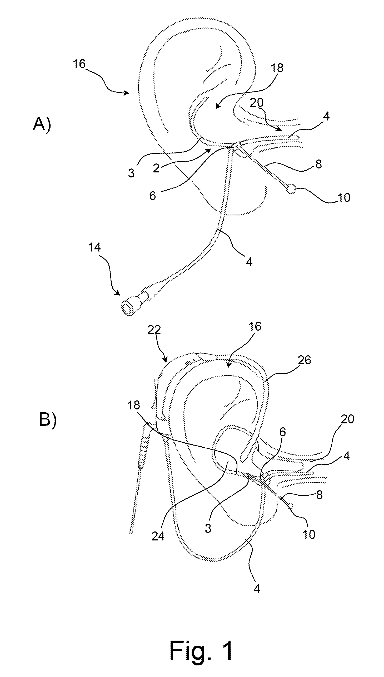 Ear strap for a probe tube