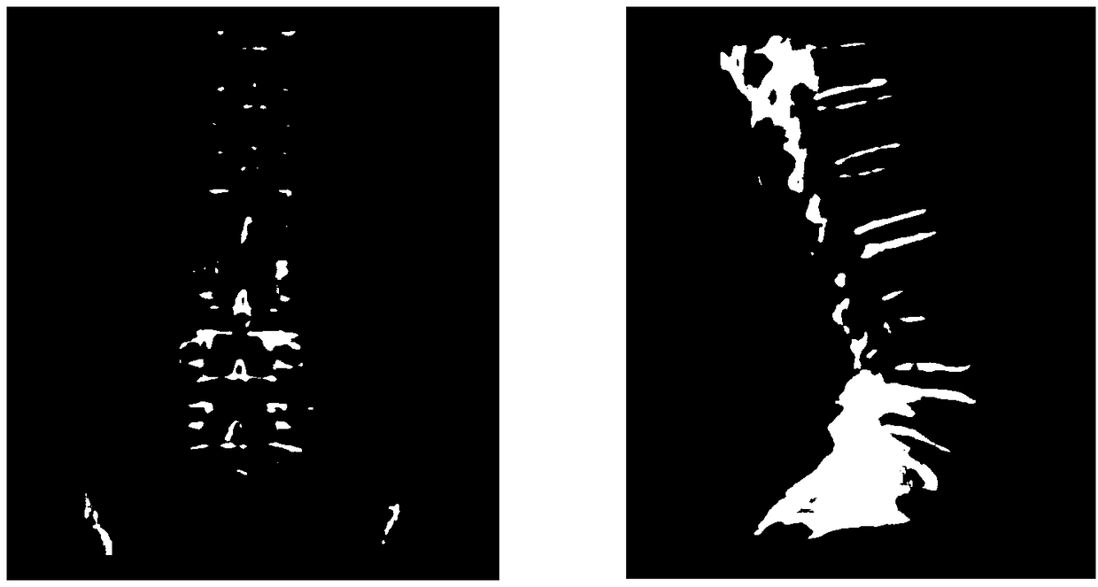 CT lumbar spine automatic locating method and device and storage medium