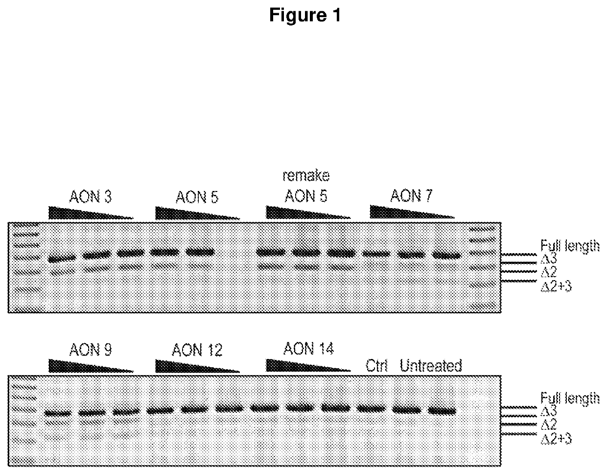 Treatment for sod1 associated disease