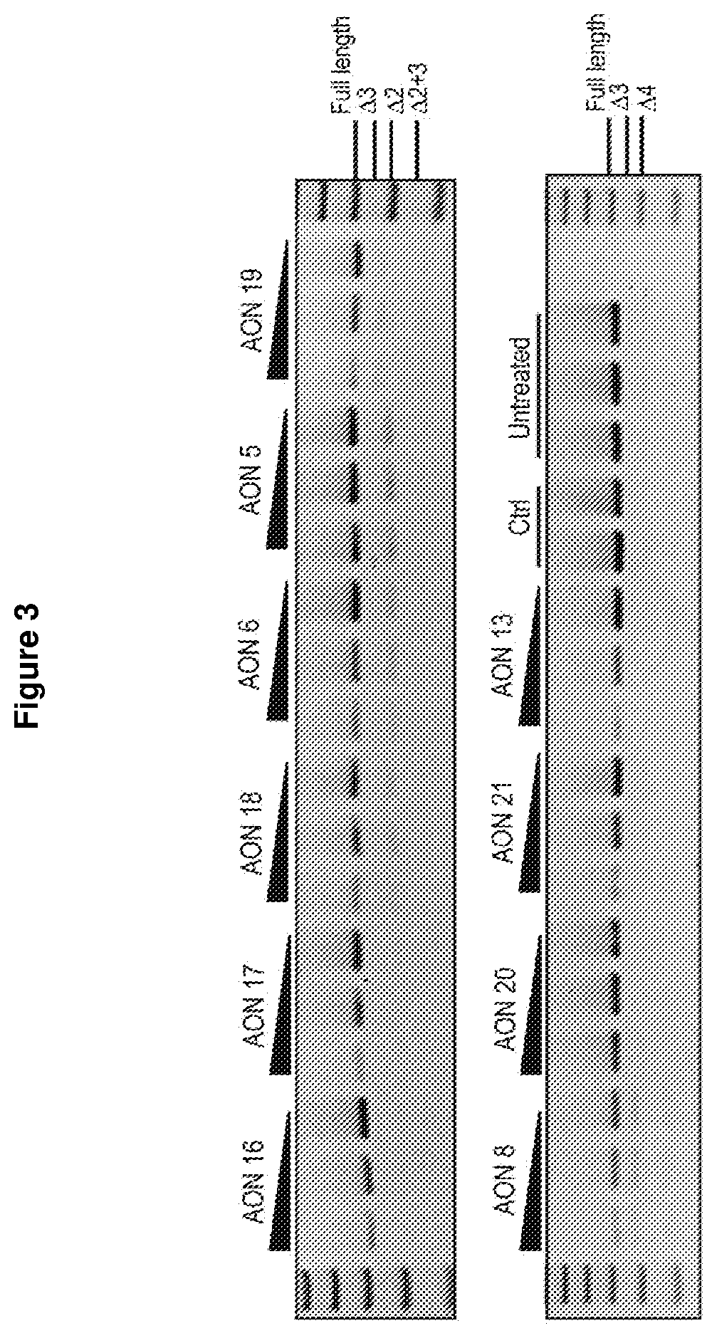 Treatment for sod1 associated disease