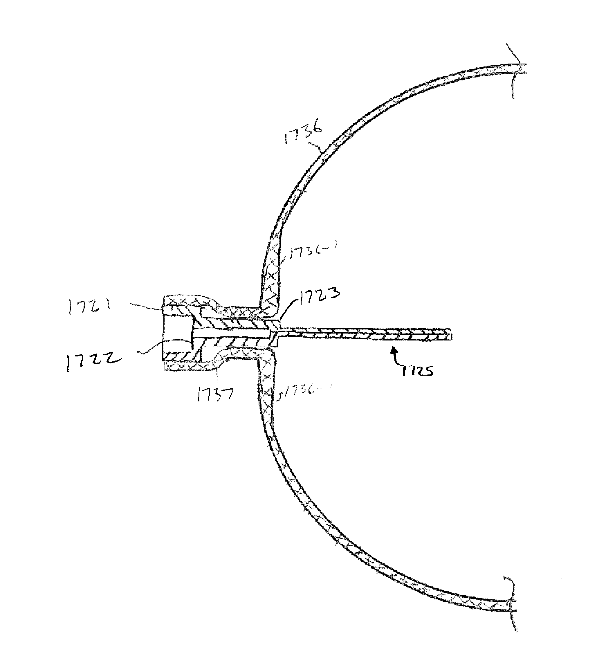 Methods and systems for performing a medical procedure