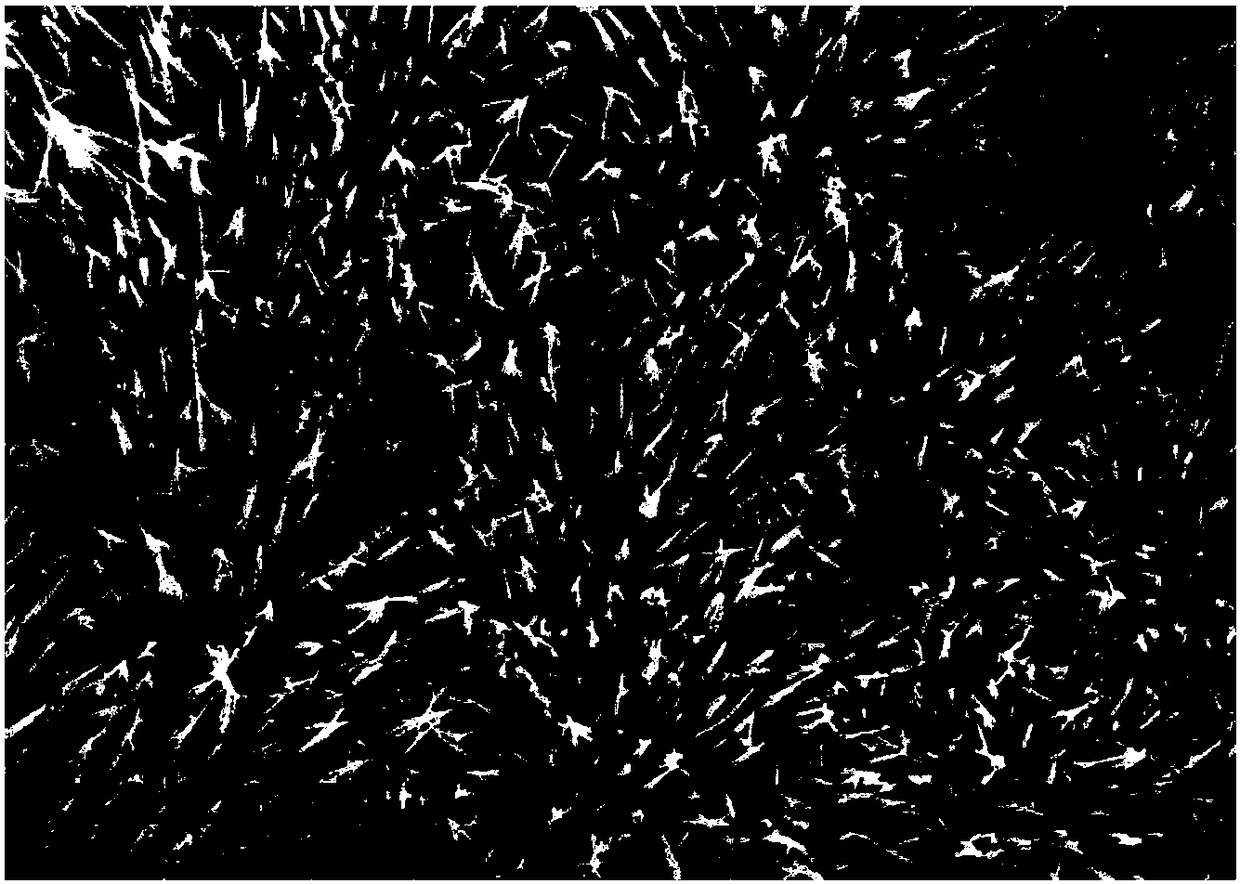 Method for realizing in-situ growth of cobalt-manganese double-metal hydroxide composite material through using nickel foam as substrate