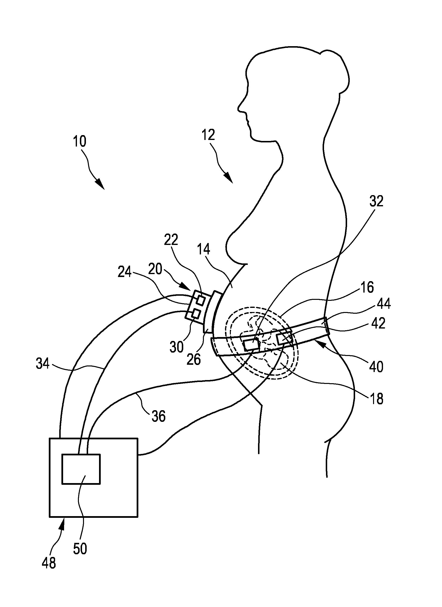 Pregnancy monitoring system and method