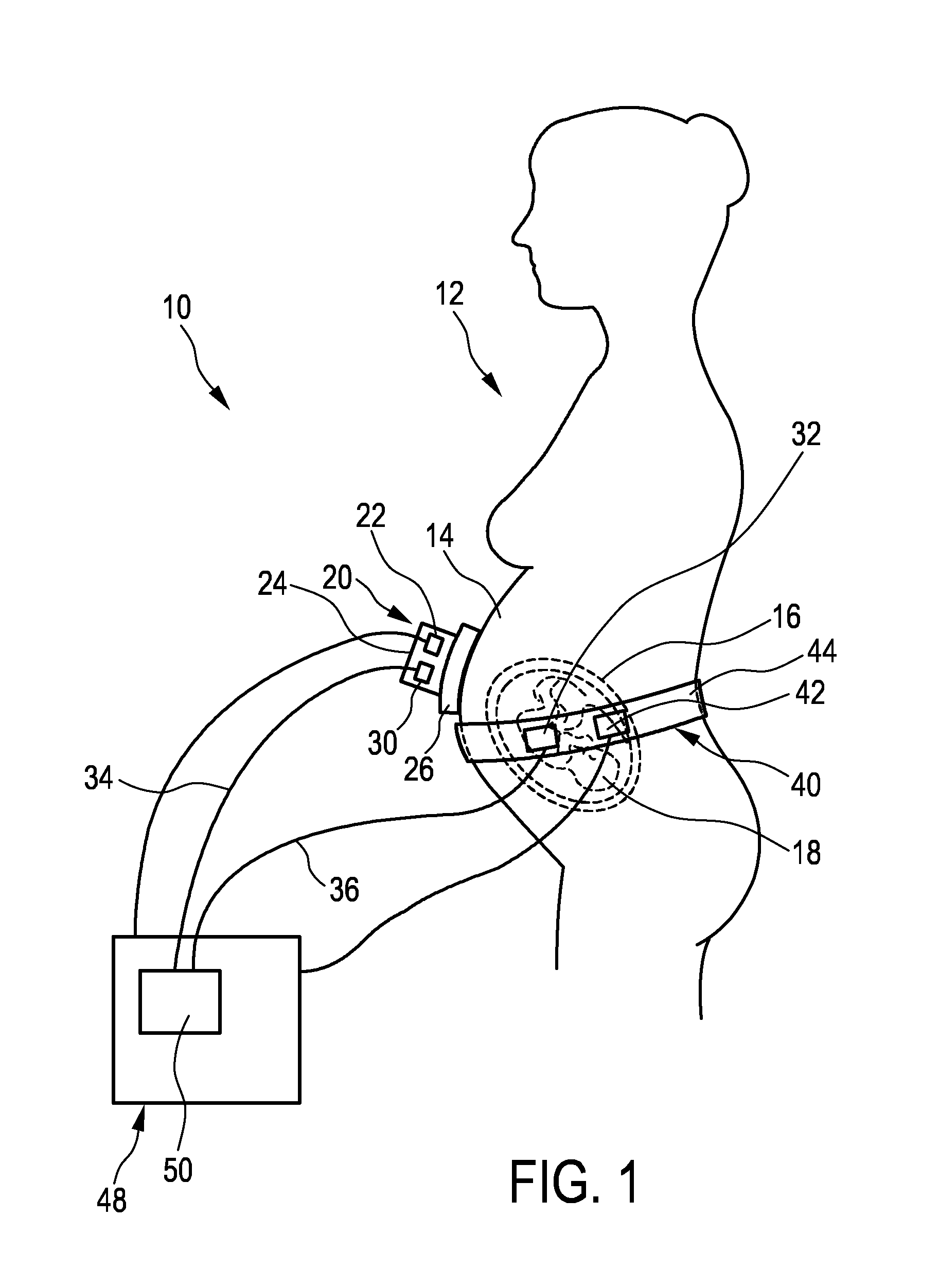 Pregnancy monitoring system and method