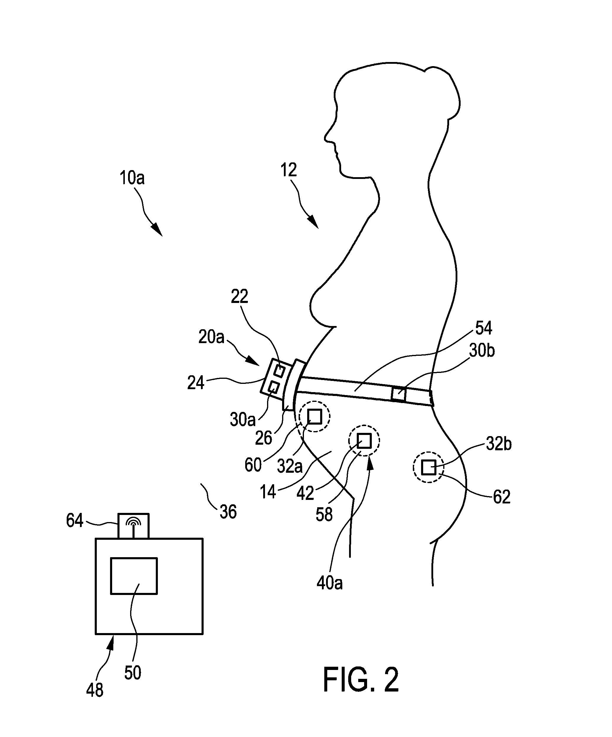 Pregnancy monitoring system and method