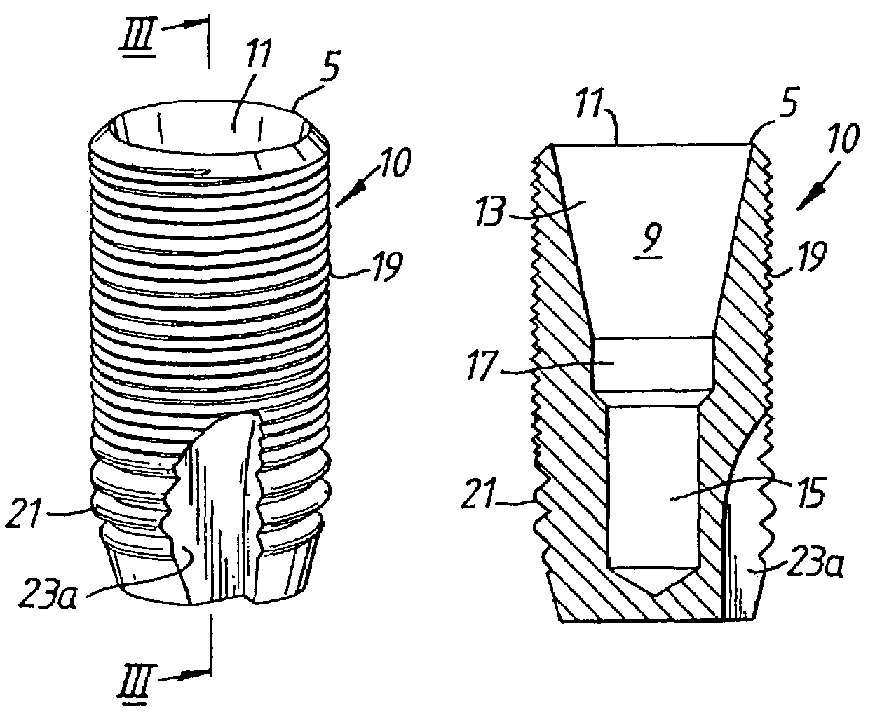 Implant having circumferentially oriented roughness