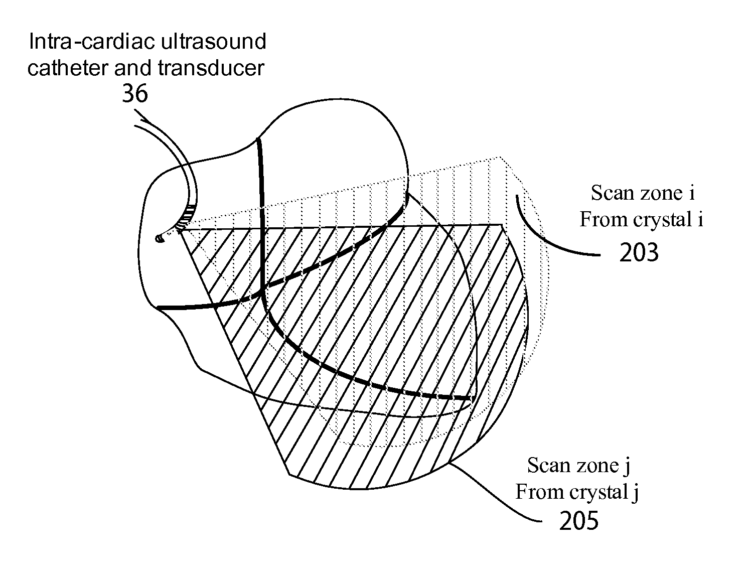 System for cardiac ultrasound image acquisition