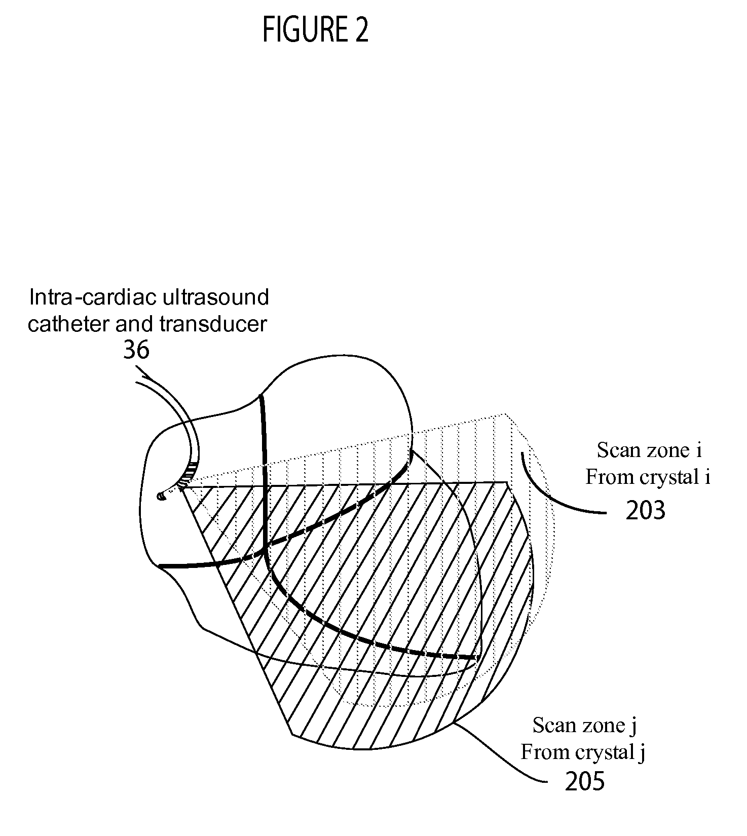 System for cardiac ultrasound image acquisition