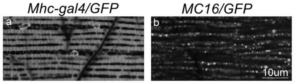 Marker for calcium overload mediated neuron death and application