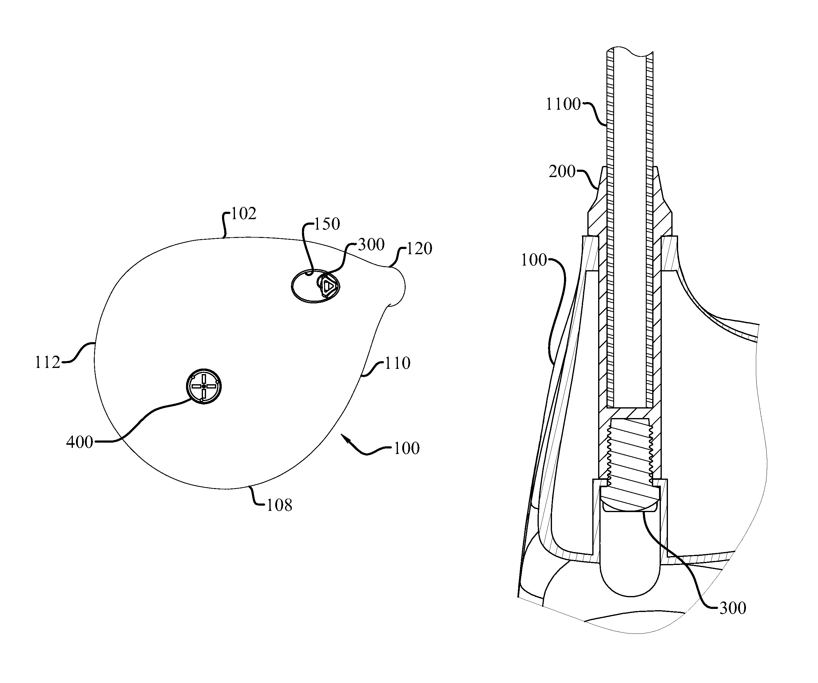 Length adjustment system for joining a golf club head to a shaft