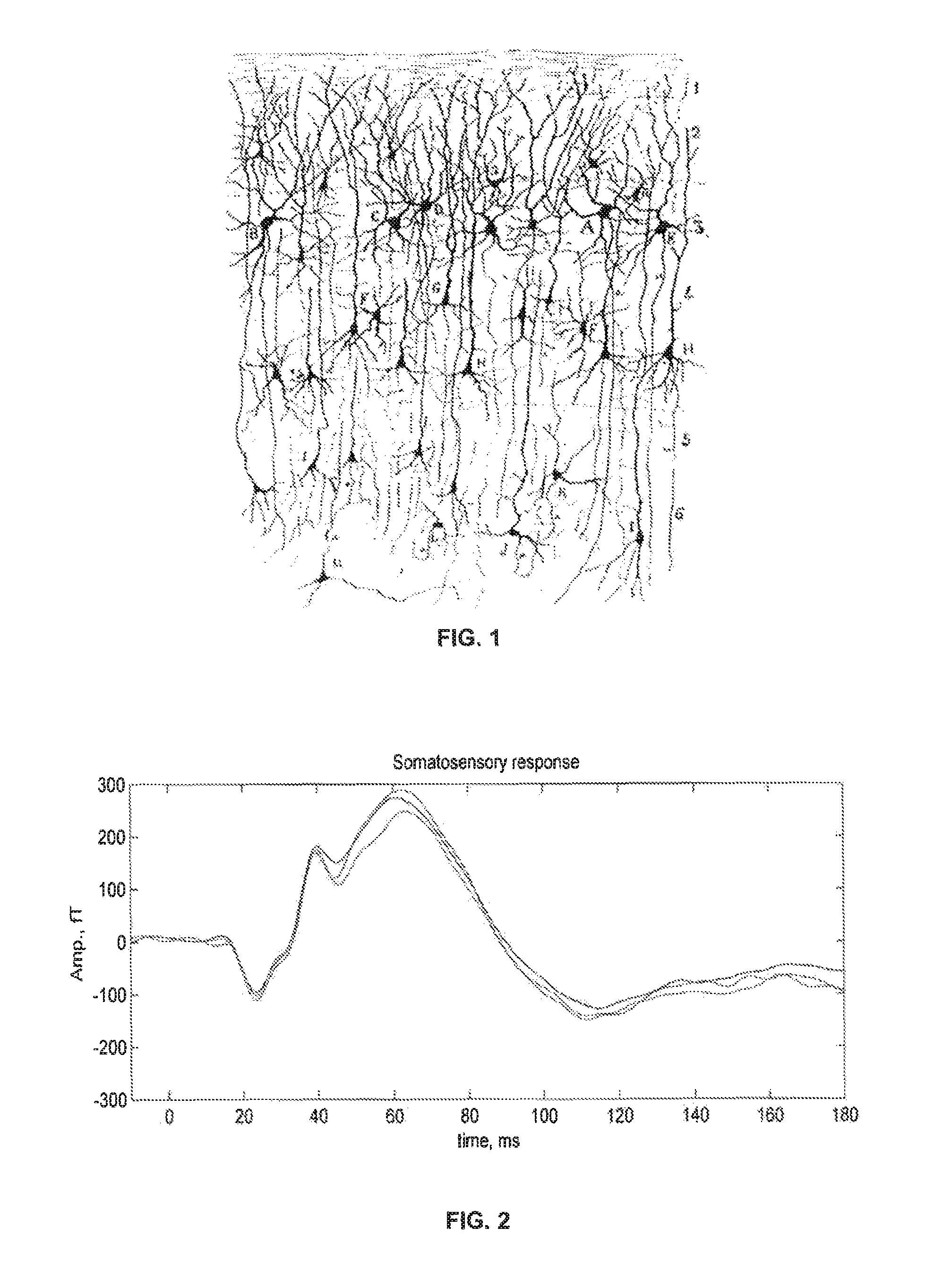 Direct imaging of neural currents using ultra-low field magnetic resonance techniques