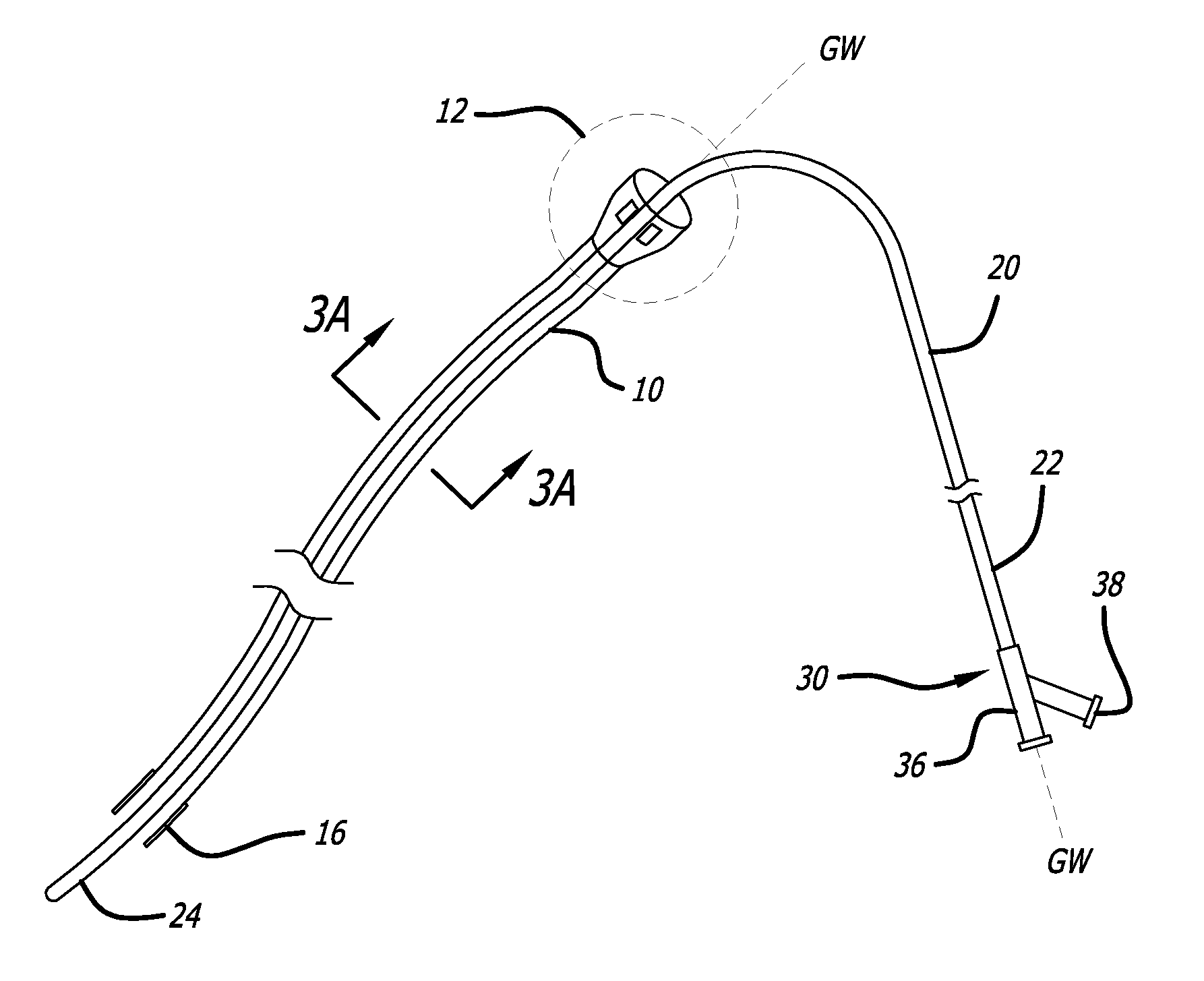 Dual Cannula System for Enteric Feeding