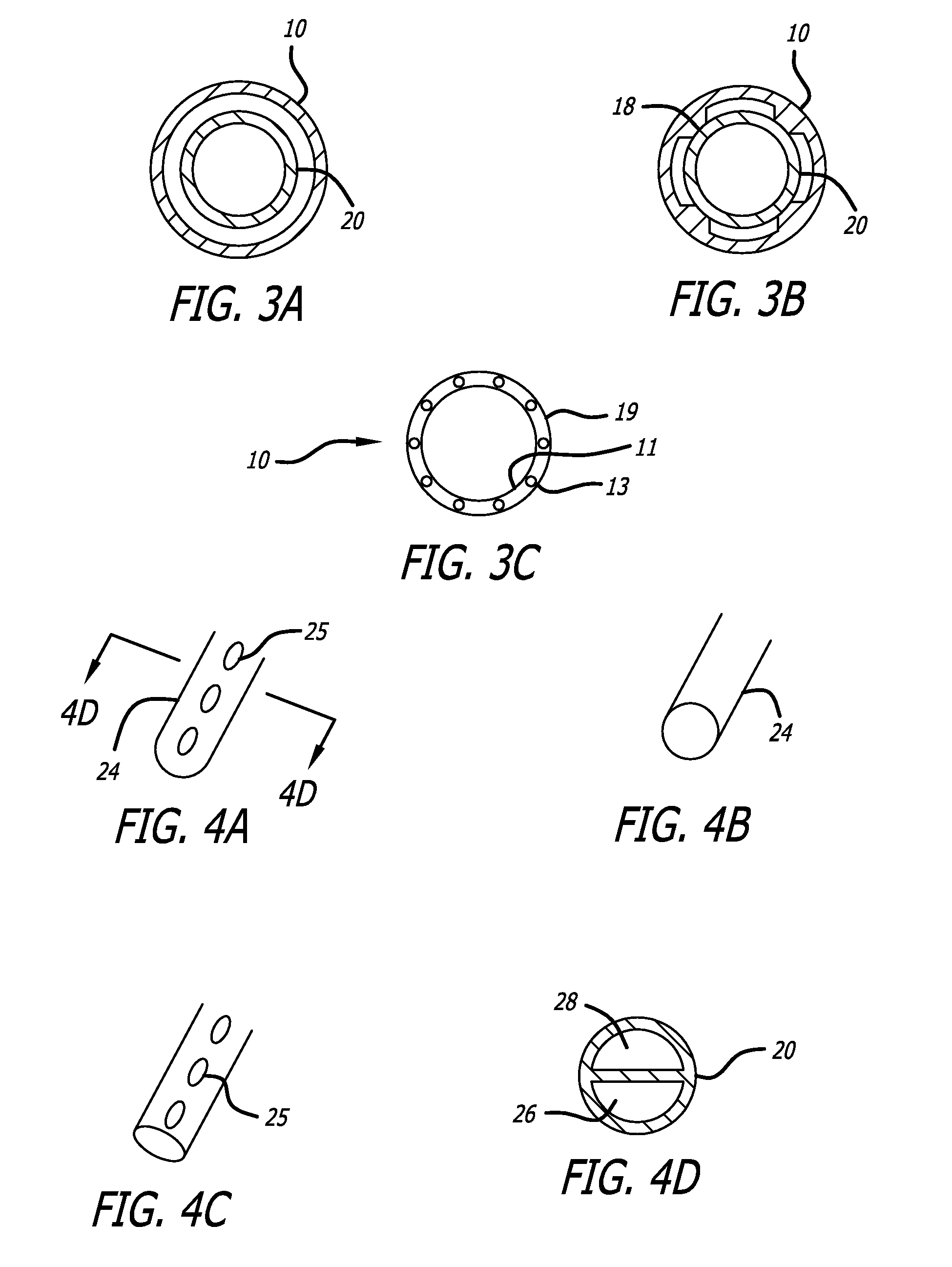 Dual Cannula System for Enteric Feeding