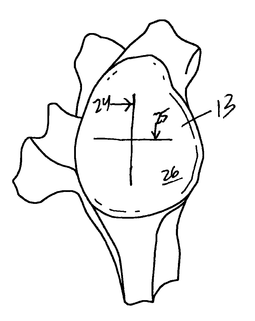 Glenoid component installation procedure and tooling for shoulder arthroplasty