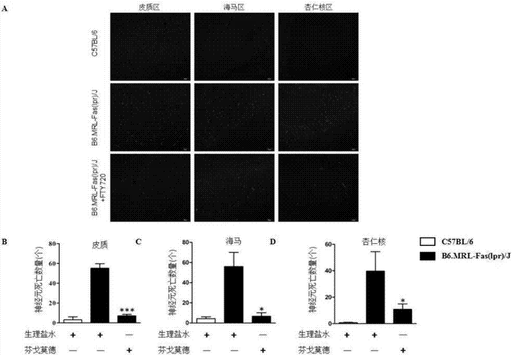 Application of fingolimod hydrochloride to preparation of medicine for treating systemic lupus erythematosus encephalopathy