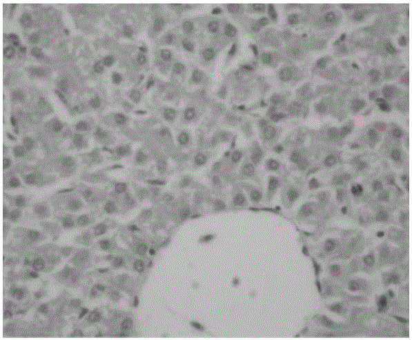 Composite Chinese herbal medicine microbial ecological agent for preventing chicken liver injury and preparation method thereof