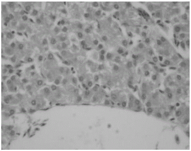 Composite Chinese herbal medicine microbial ecological agent for preventing chicken liver injury and preparation method thereof