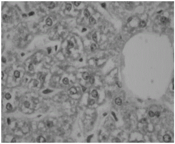 Composite Chinese herbal medicine microbial ecological agent for preventing chicken liver injury and preparation method thereof