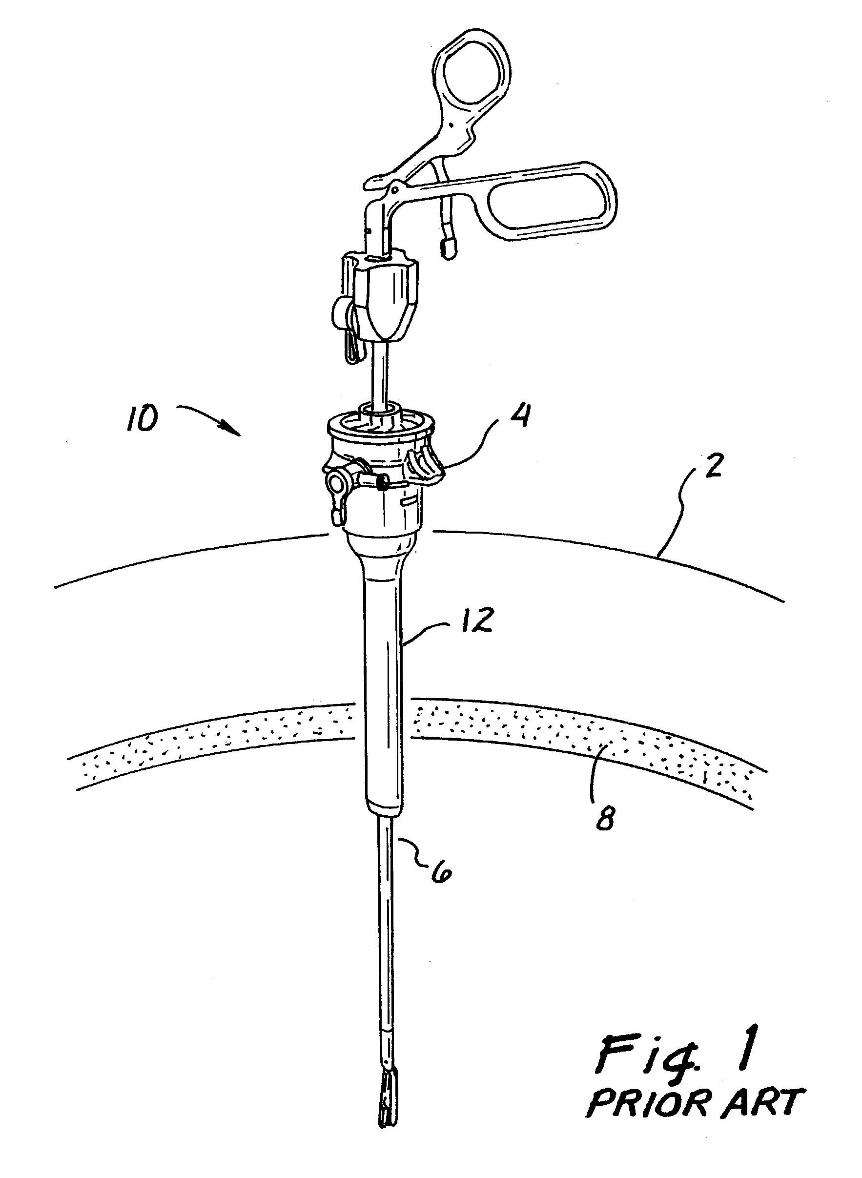 Universal access seal