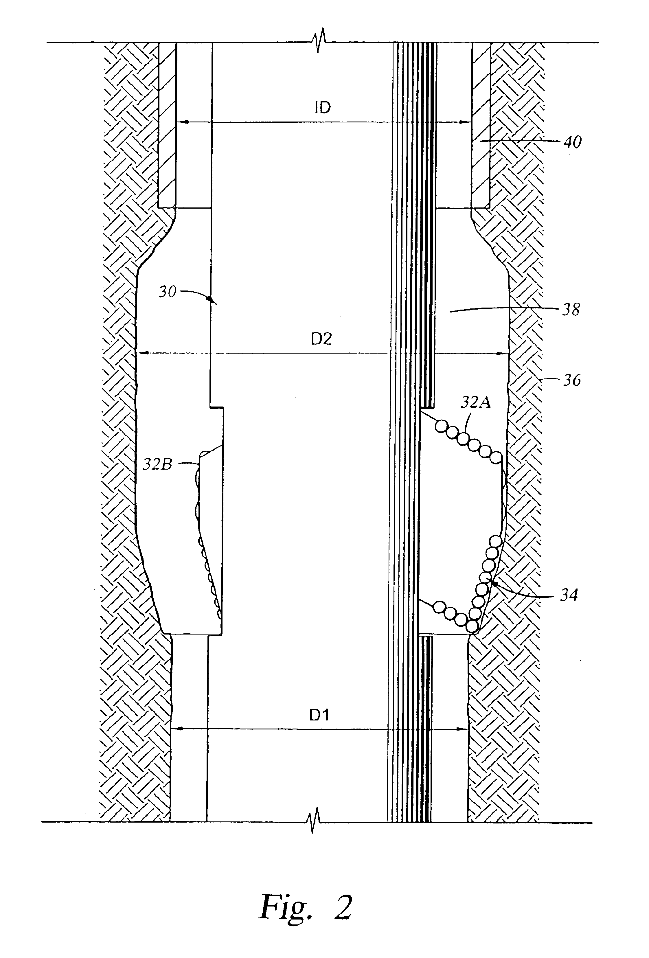 Advanced expandable reaming tool