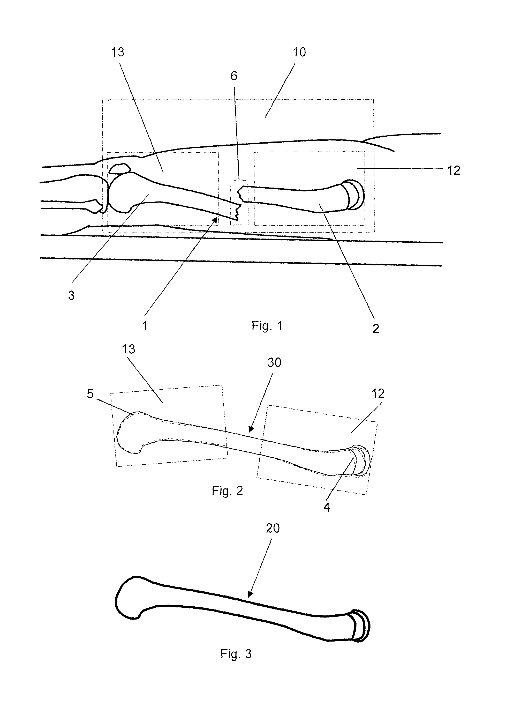 Method for generating a 3D reference computer model of at least one anatomical structure