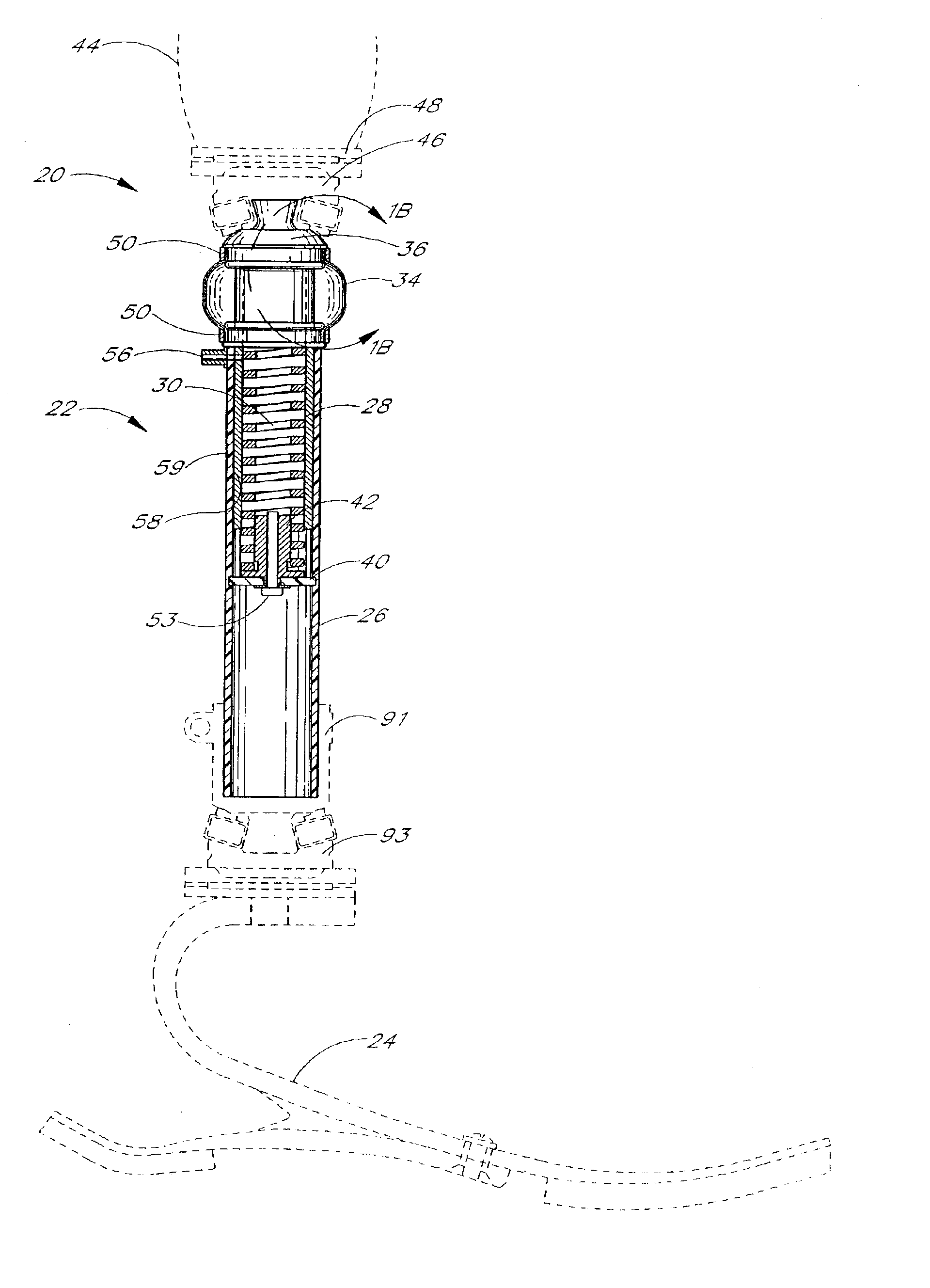 Active shock module prosthesis