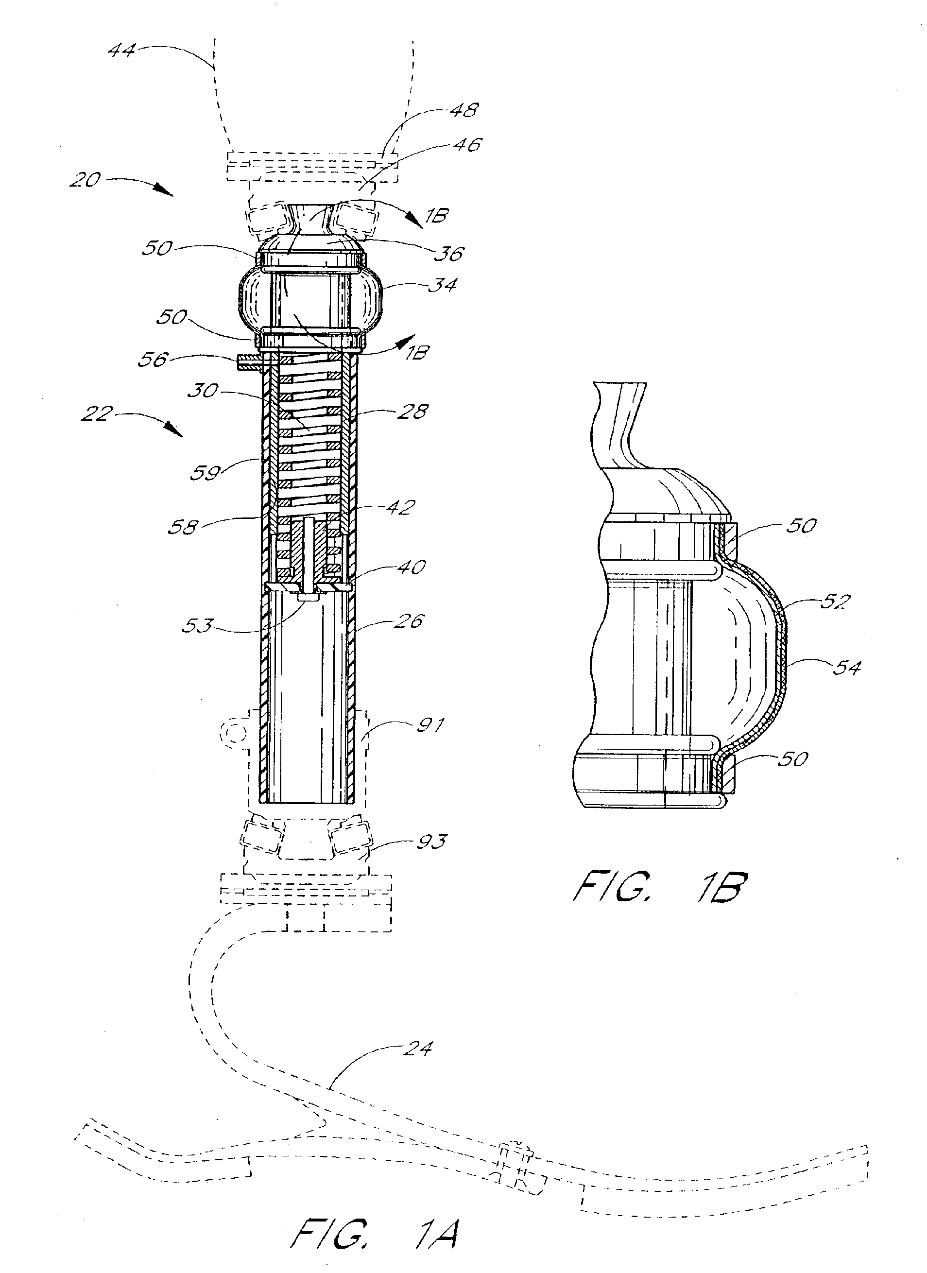 Active shock module prosthesis