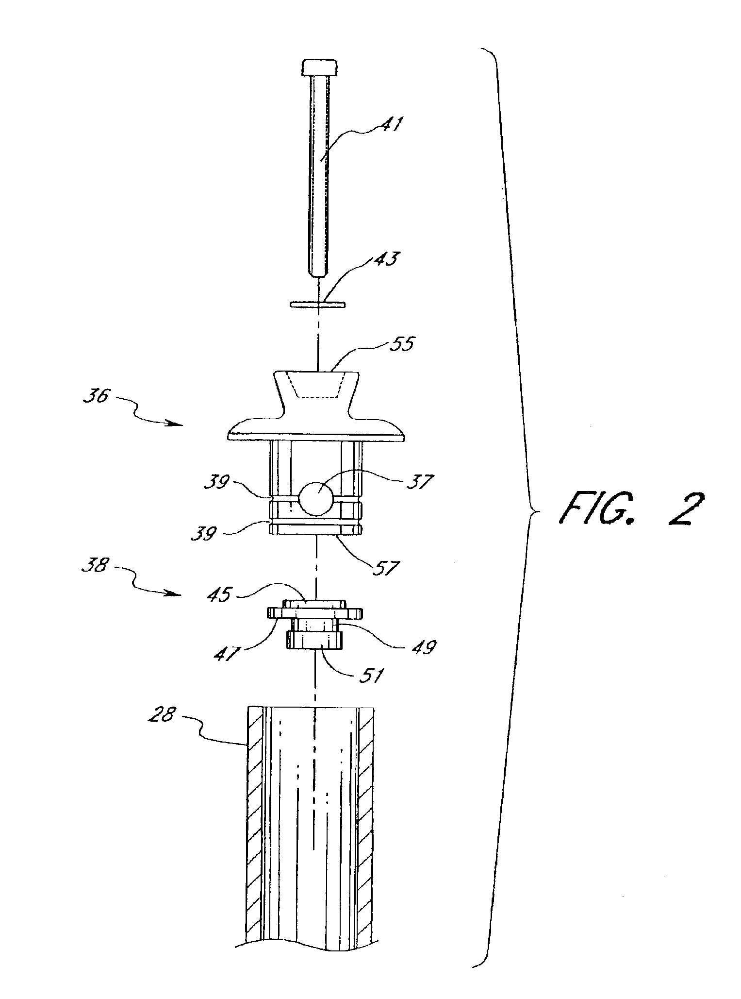 Active shock module prosthesis