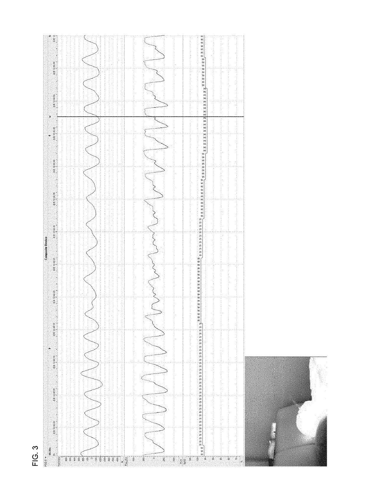 Breath analysis system using gas image detection method