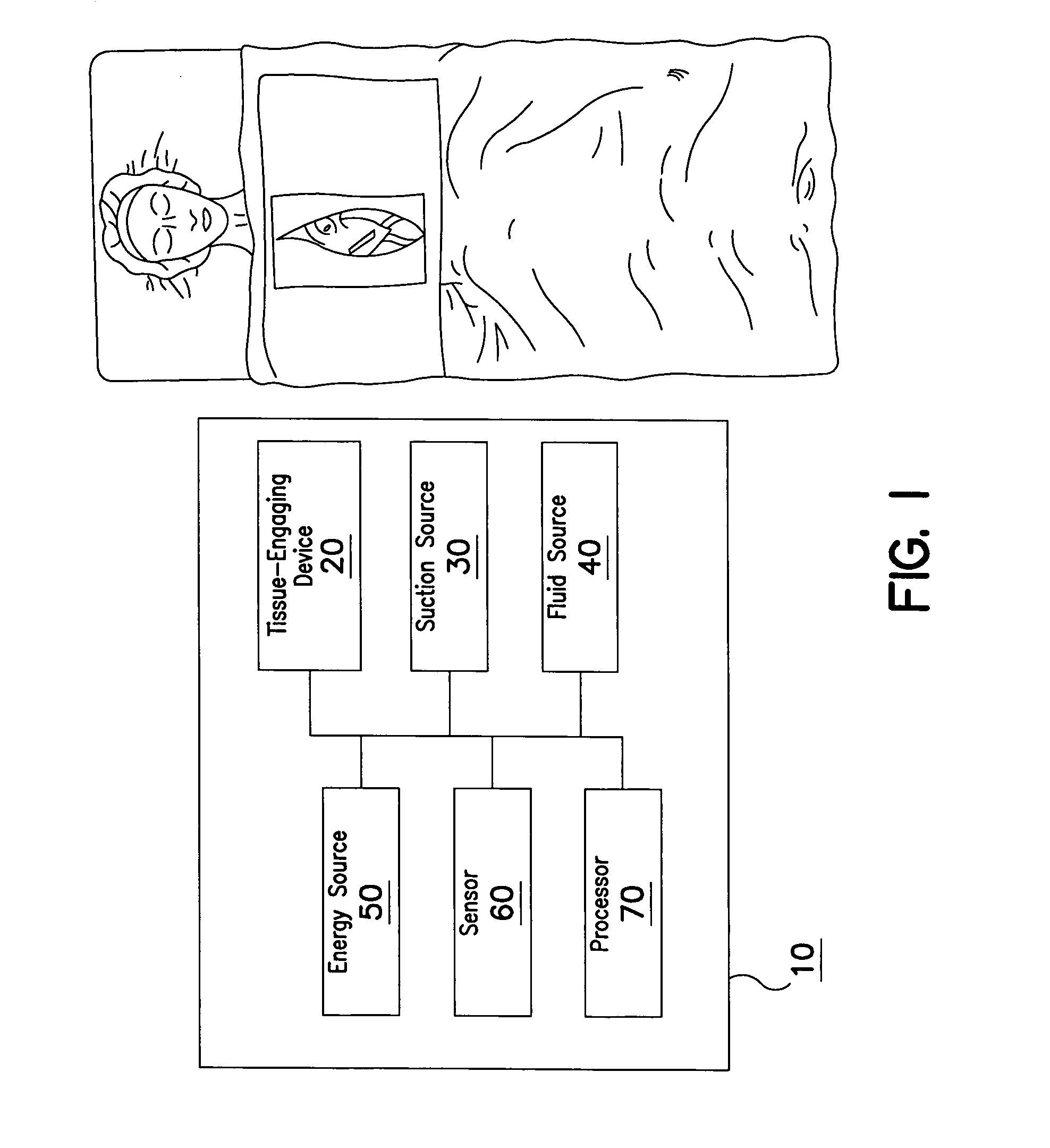 Method and system for organ positioning and stabilization