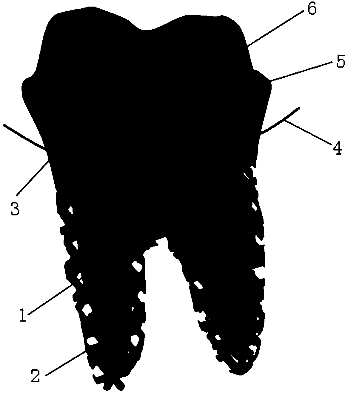 Preparation method of 3D printing porous root-shaped implant tooth